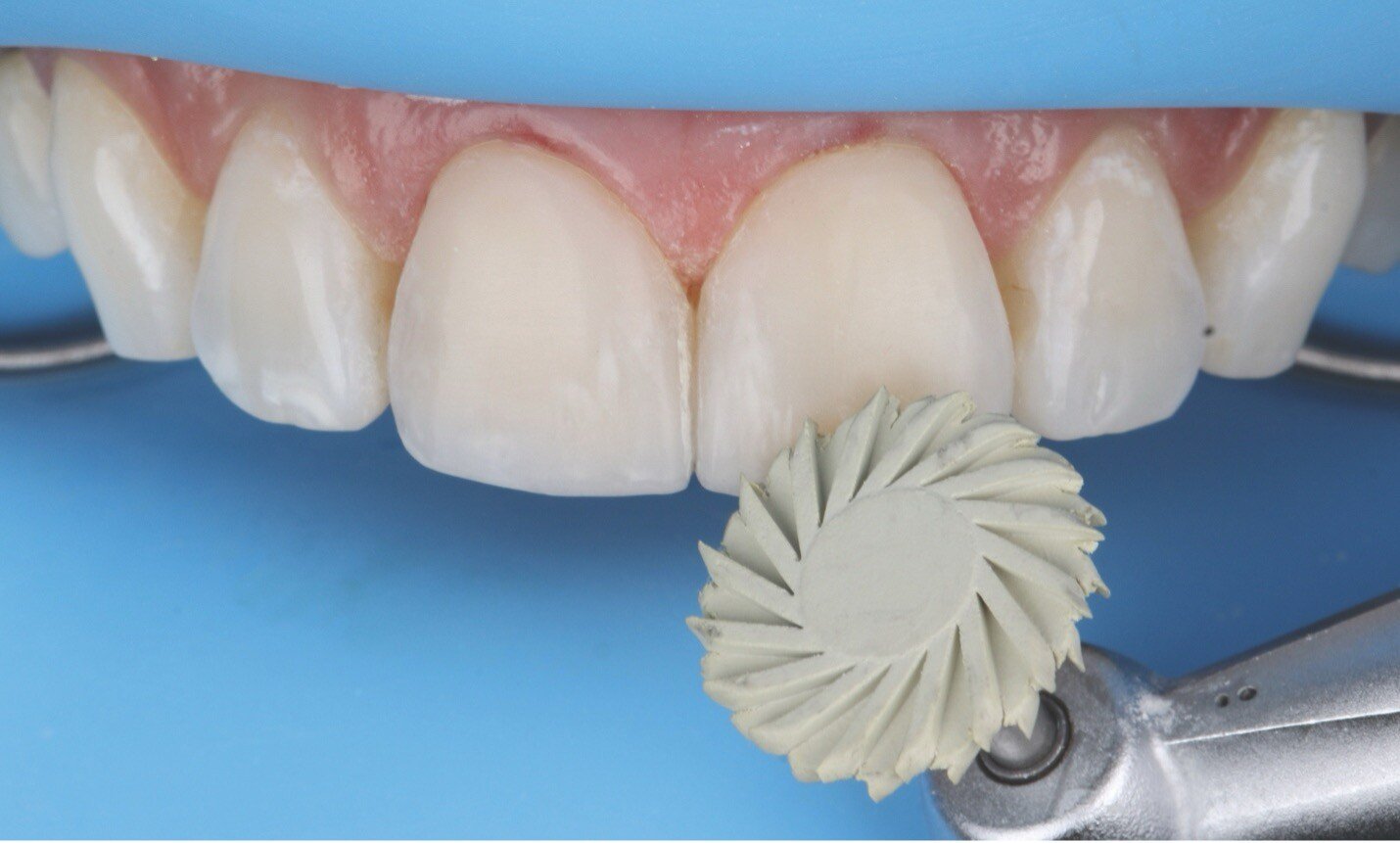 Picture10-Feb-28-2025-06-03-31-4855-PM