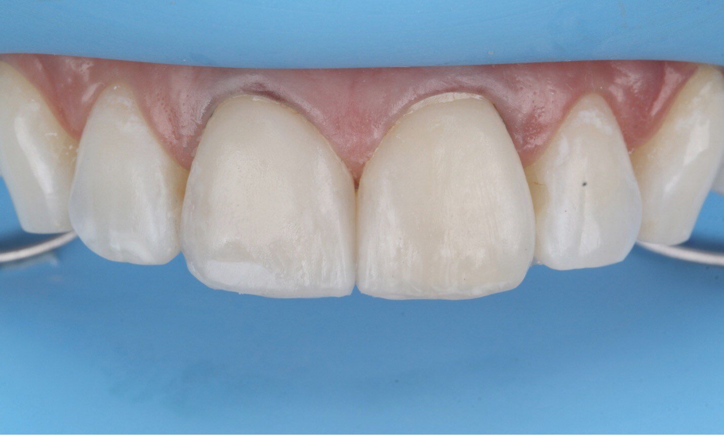 Picture8-Feb-28-2025-06-03-31-3093-PM